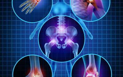 Natural Relief Options for Sacroiliitis in Hot Springs, AR to Ease Your Pain Fast